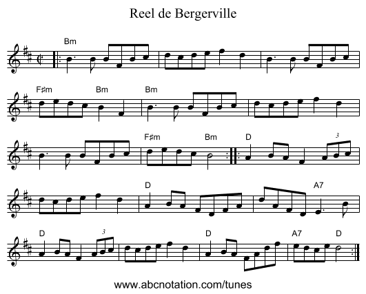 Reel de Bergerville - staff notation