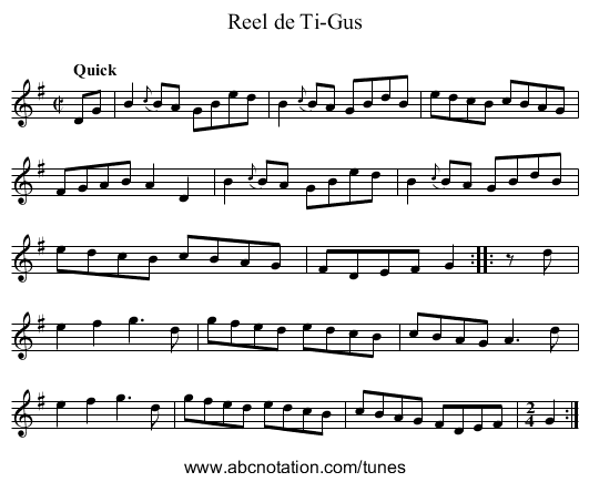 Reel de Ti-Gus - staff notation