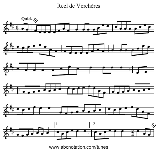 Reel de Verchères - staff notation