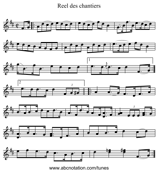 Reel des chantiers - staff notation