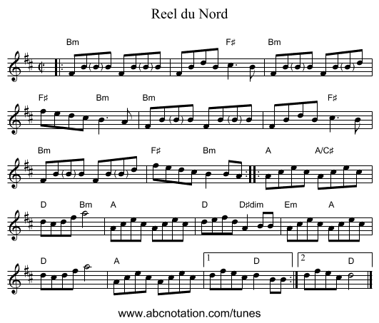 Reel du Nord - staff notation