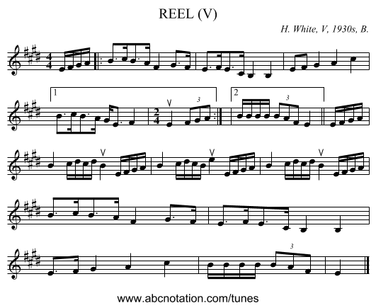 REEL (V) - staff notation