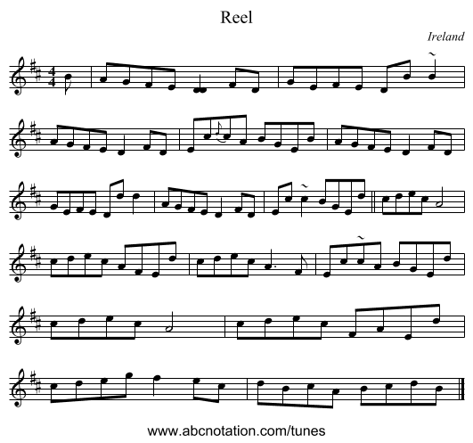 Reel - staff notation