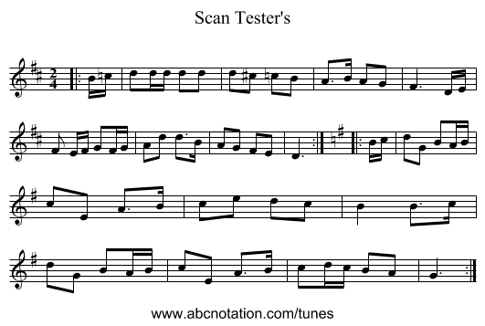 Scan Tester's - staff notation