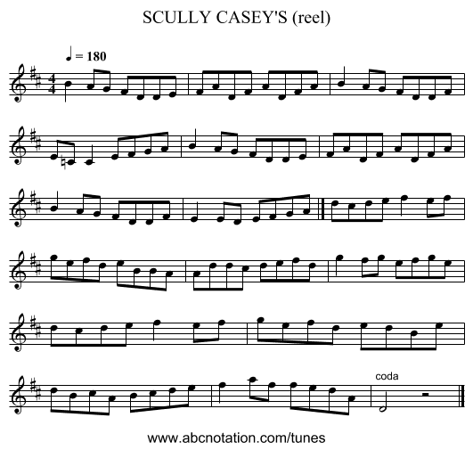 SCULLY CASEY'S (reel) - staff notation