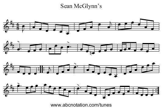 Sean McGlynn’s - staff notation