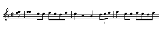 Shoe Heels Cracken on the Floor - staff notation