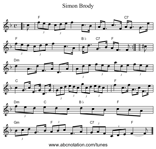 Simon Brody - staff notation