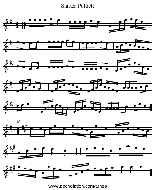 Slatter Polkett - staff notation