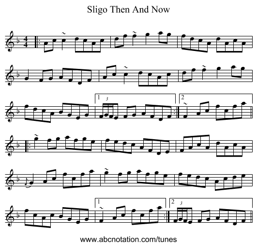 Sligo Then And Now - staff notation