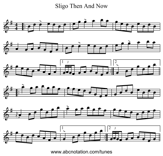 Sligo Then And Now - staff notation