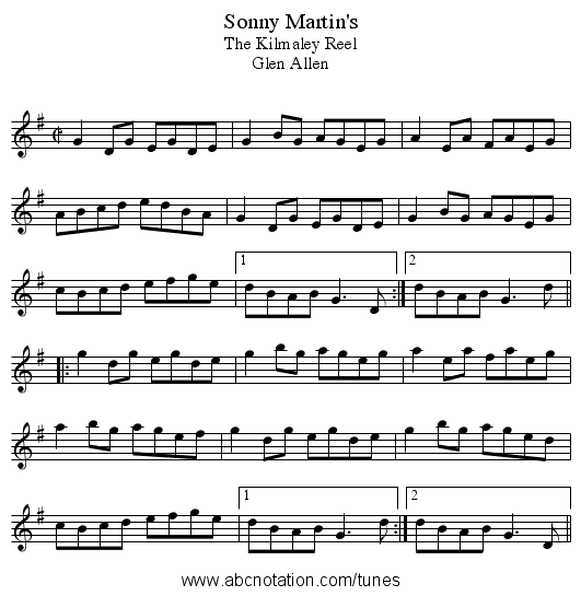 Sonny Martin's - staff notation