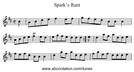 Spark’s Rant - staff notation