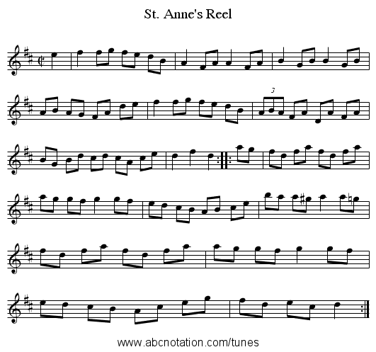 St. Anne's Reel - staff notation