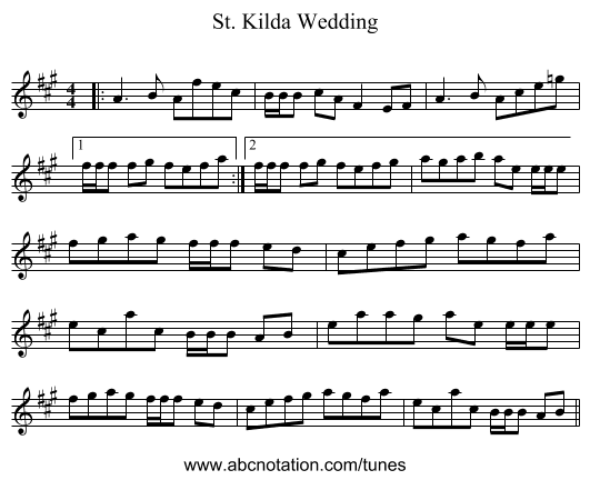 St. Kilda Wedding - staff notation