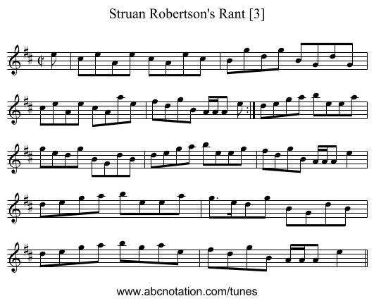 Struan Robertson's Rant [3] - staff notation