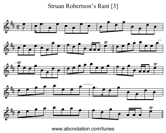 Struan Robertson’s Rant [3] - staff notation