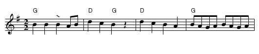 Szekely Friss - staff notation