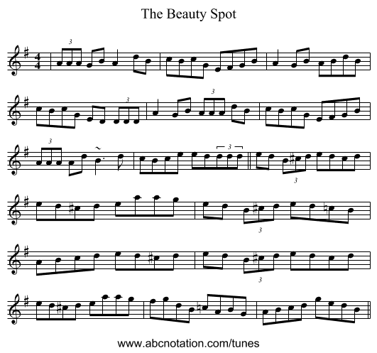 The Beauty Spot - staff notation