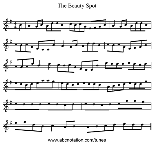 The Beauty Spot - staff notation