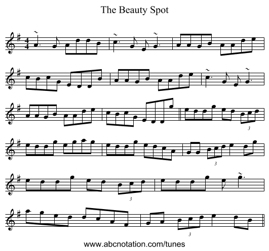 The Beauty Spot - staff notation