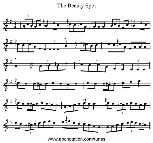 The Beauty Spot - staff notation