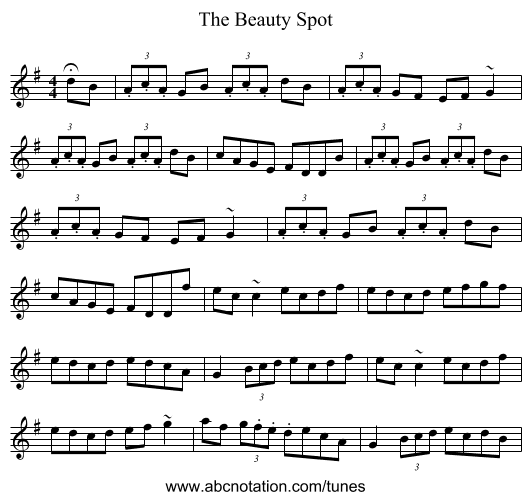 The Beauty Spot - staff notation