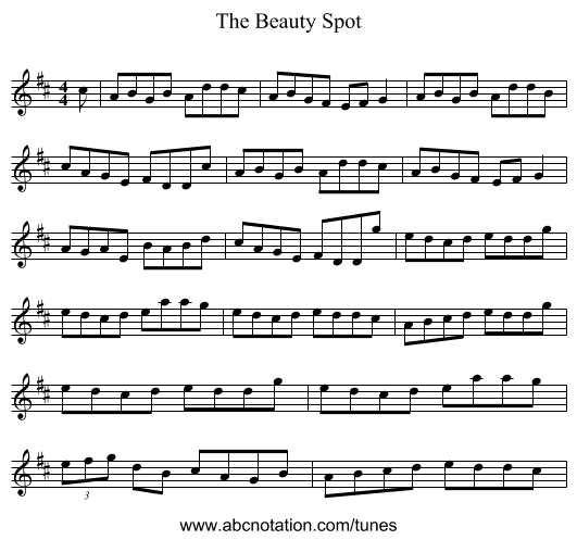 The Beauty Spot - staff notation