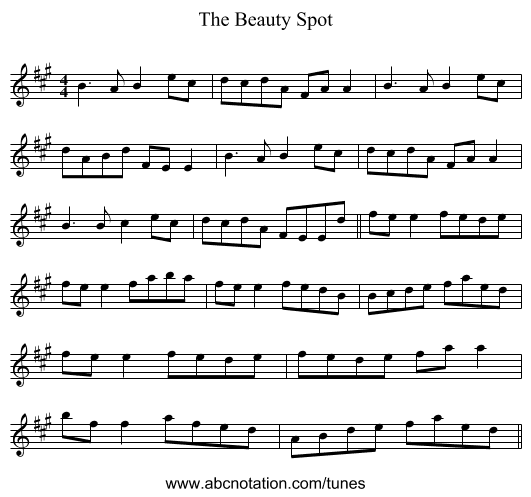 The Beauty Spot - staff notation