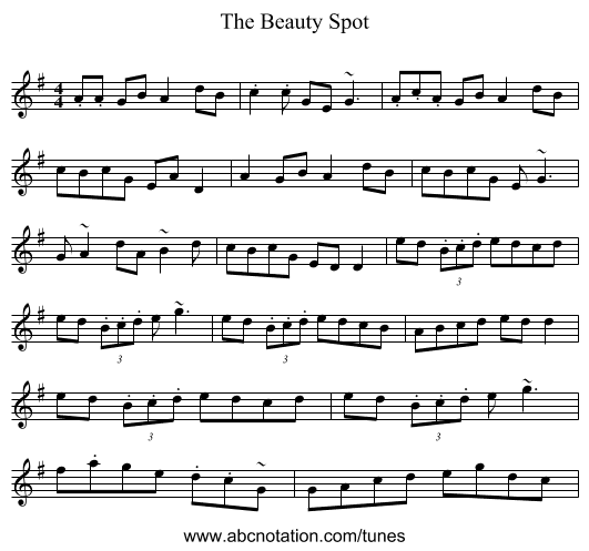 The Beauty Spot - staff notation