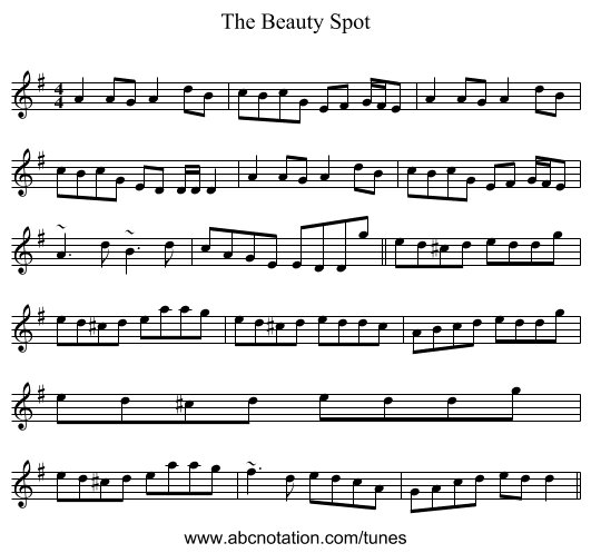 The Beauty Spot - staff notation