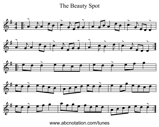 The Beauty Spot - staff notation