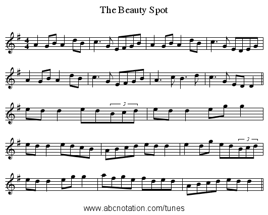 The Beauty Spot - staff notation