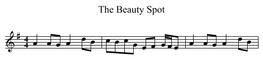 The Beauty Spot - staff notation