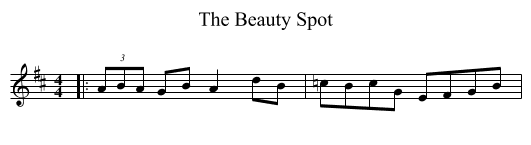 The Beauty Spot - staff notation