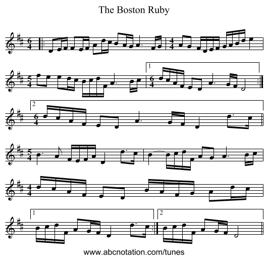 The Boston Ruby - staff notation