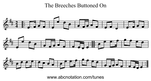 The Breeches Buttoned On - staff notation