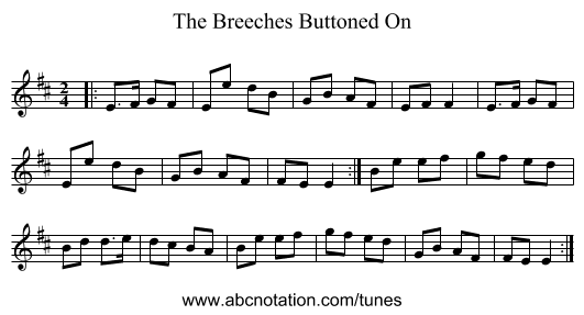 The Breeches Buttoned On - staff notation
