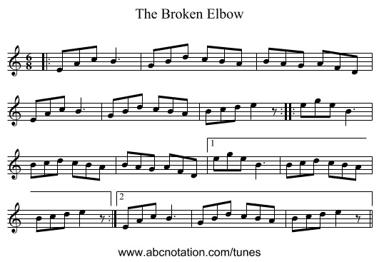 The Broken Elbow - staff notation