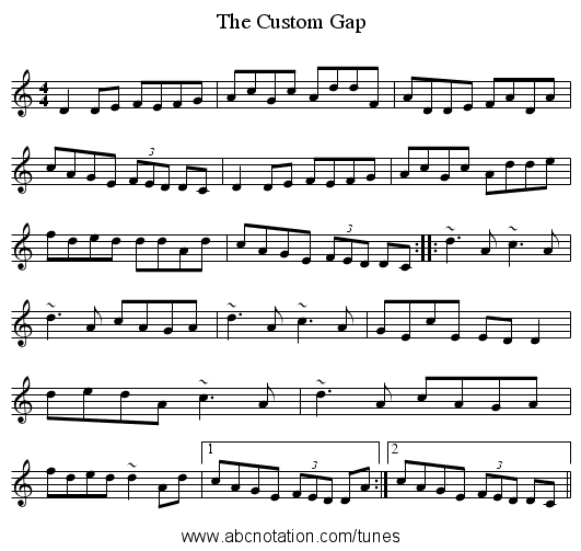The Custom Gap - staff notation