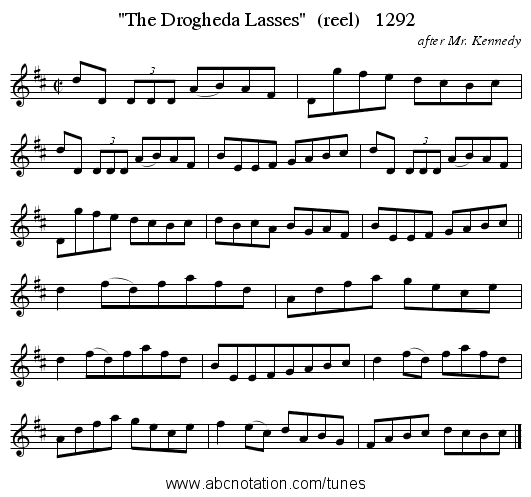 The Drogheda Lasses  (reel)   1292 - staff notation