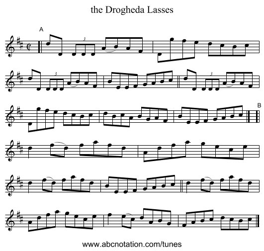 the Drogheda Lasses - staff notation