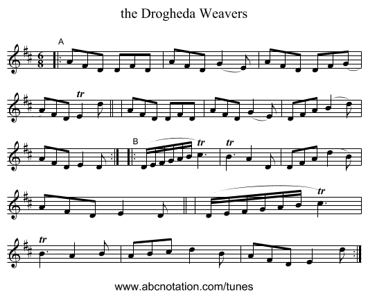 the Drogheda Weavers - staff notation