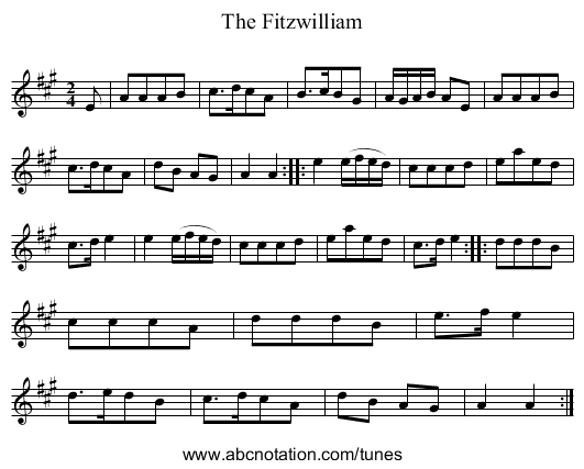 The Fitzwilliam - staff notation