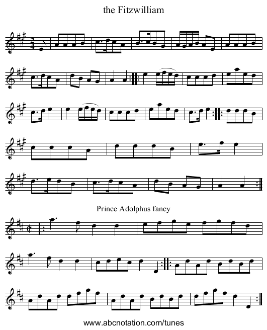 the Fitzwilliam - staff notation