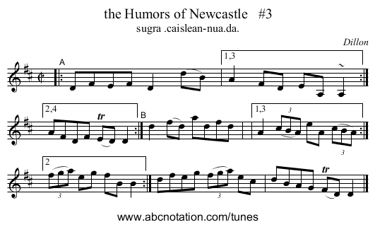 the Humors of Newcastle #3 - staff notation