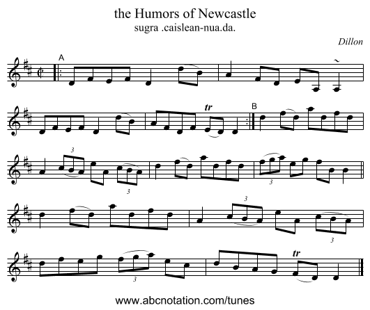 the Humors of Newcastle - staff notation