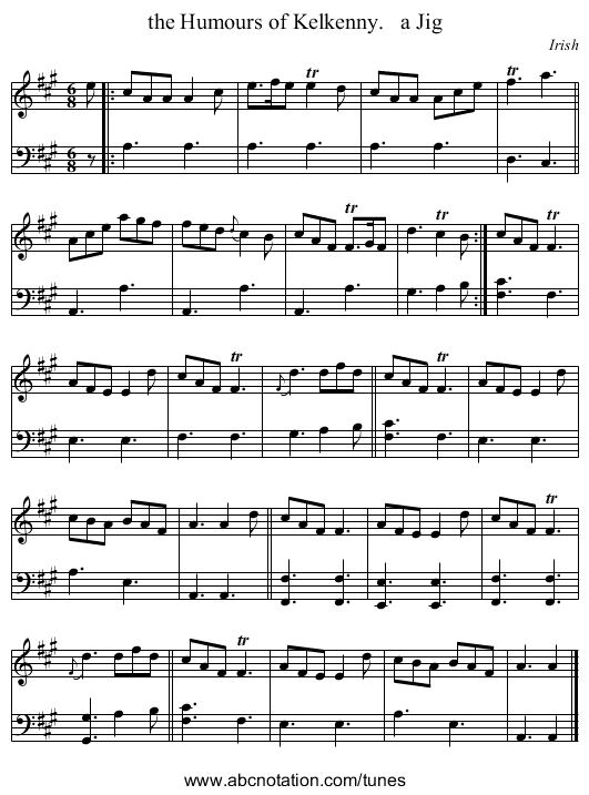the Humours of Kelkenny.   a Jig - staff notation