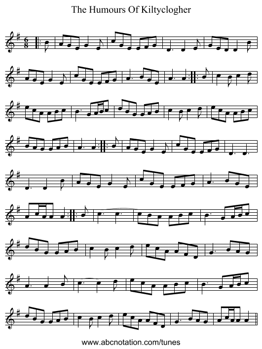 The Humours Of Kiltyclogher - staff notation