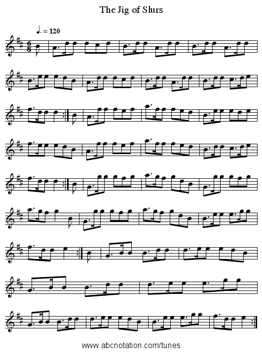 The Jig of Slurs - staff notation